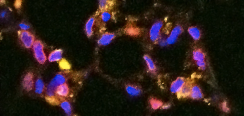 ImageJ=1.49v
unit=cm